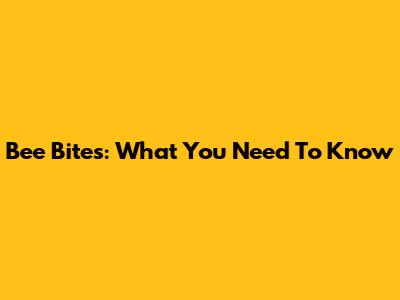 Bee Bites: What You Need To Know