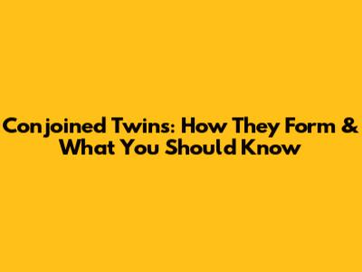 Conjoined Twins: How They Form & What You Should Know