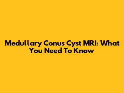 Medullary Conus Cyst MRI: What You Need To Know