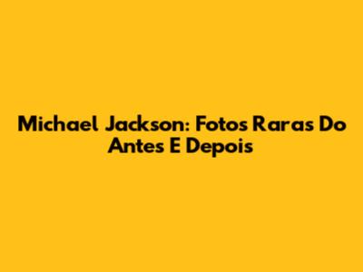 Michael Jackson: Fotos Raras Do Antes E Depois