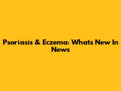 Psoriasis & Eczema: What's New In News