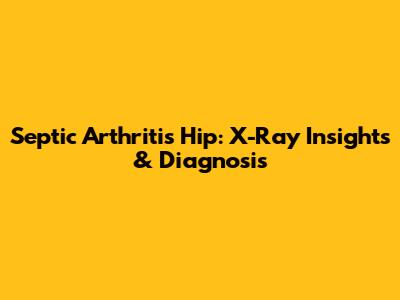 Septic Arthritis Hip: X-Ray Insights & Diagnosis